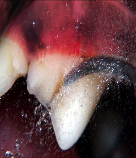 A scaler on a dog&#039;s tooth